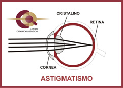 astigmatismo2